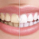 Before & After Images Comparison WordPress Plugin - WordPress / Media