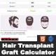 Hair Transplant Graft Calculator - HTML5